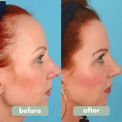 WM Reverse - Hair Growth Serum