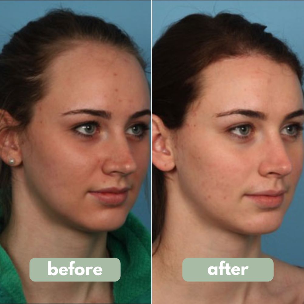 WM Reverse - Hair Growth Serum